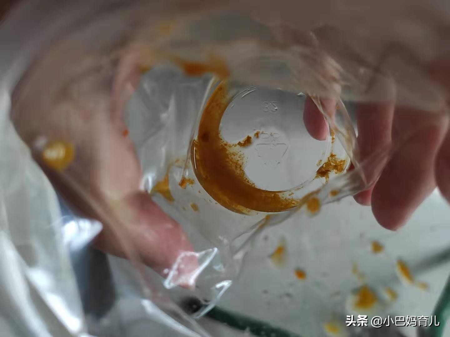 宝宝喝奶粉后拉肚子?可能是这 3 个原因导致 宝宝喝奶粉后拉肚子?可能是这 3 个原因导致